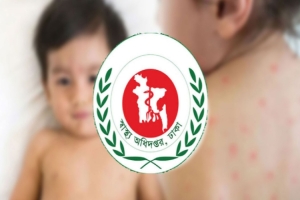 ২৪ ঘণ্টায় হাম ও উপসর্গে আরও ৫ শিশুর মৃত্যু