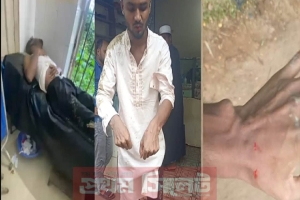 মৌলভীবাজারে সড়ক নির্মাণে অনিয়মের ভিডিও ধারণ করায় যুবকের ওপর হামলা